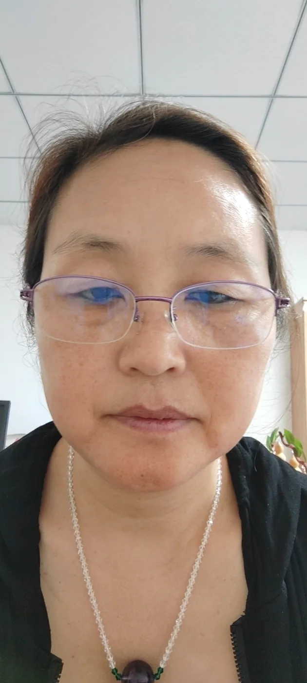 米艳巧